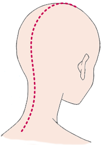 エモーションコードでは頭部に磁石(磁気)をあてるエリア